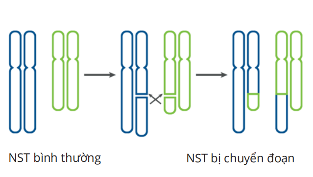 xét nghiệm chẩn đoán bất thường cấu trúc NST trước chuyển phôi