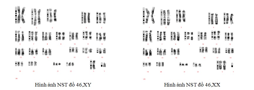 Xét nghiệm karyotype (nhiễm sắc thể đồ)