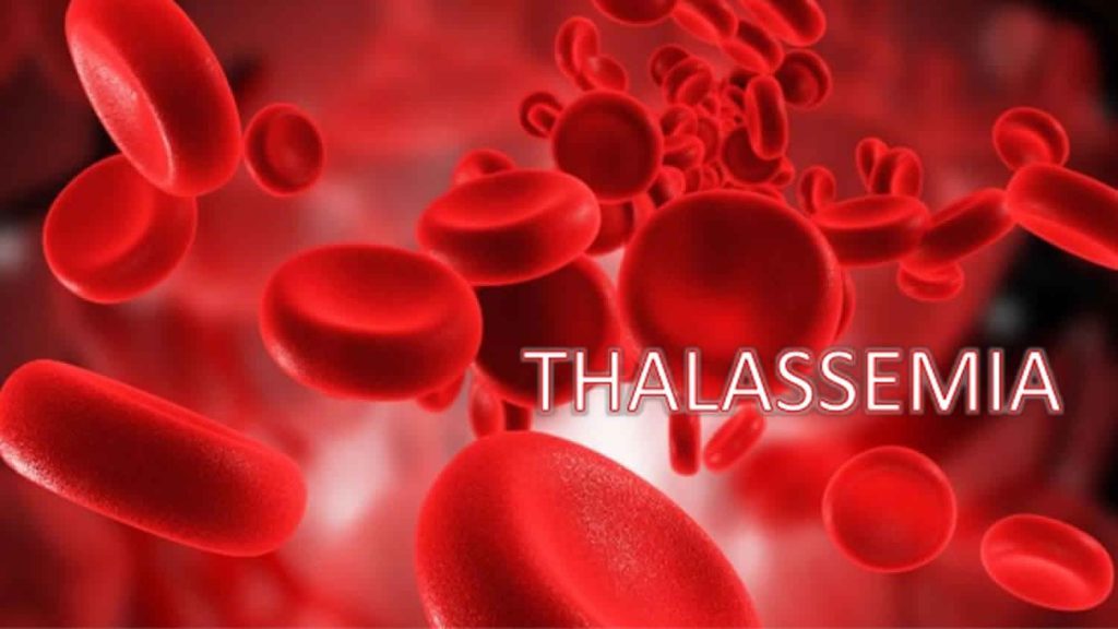 Bệnh Thalassemia