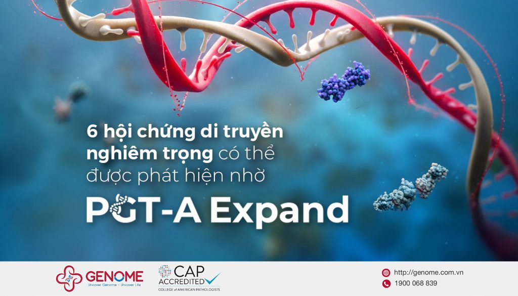 6 hội chứng di truyền nghiêm trọng có thể được phát hiện nhờ PGT-A Expand