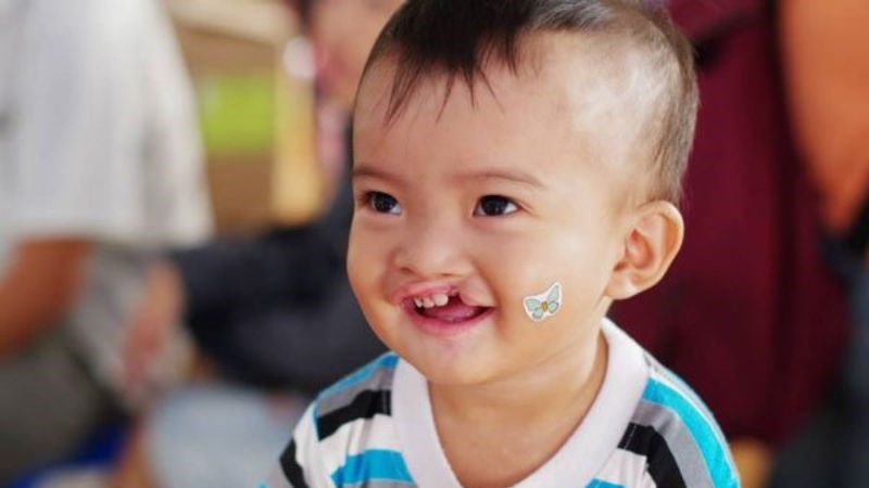 Thông tin cần biết về Hội chứng Edwards