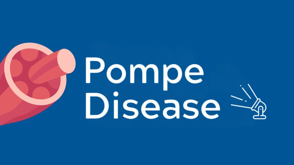 Bệnh Pompe (Nhóm bệnh Rối loạn chuyển hóa): Sàng lọc chẩn đoán và dự phòng