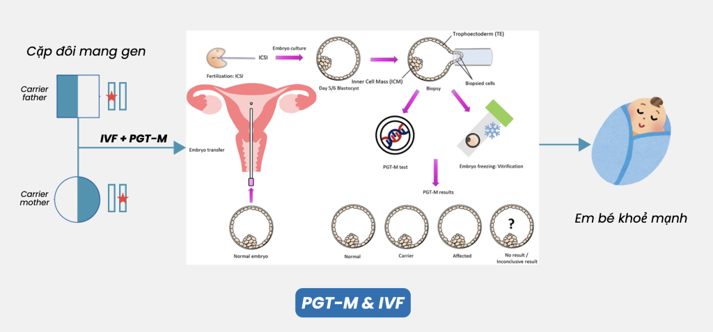 Quy trình IVF kết hợp PGT-M