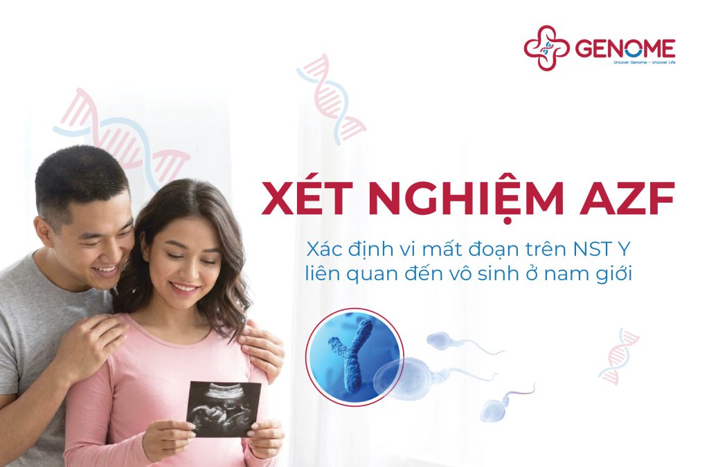 Xét nghiệm AZF xác định vi mất đoạn trên NST Y liên quan đến vô sinh ở nam giới