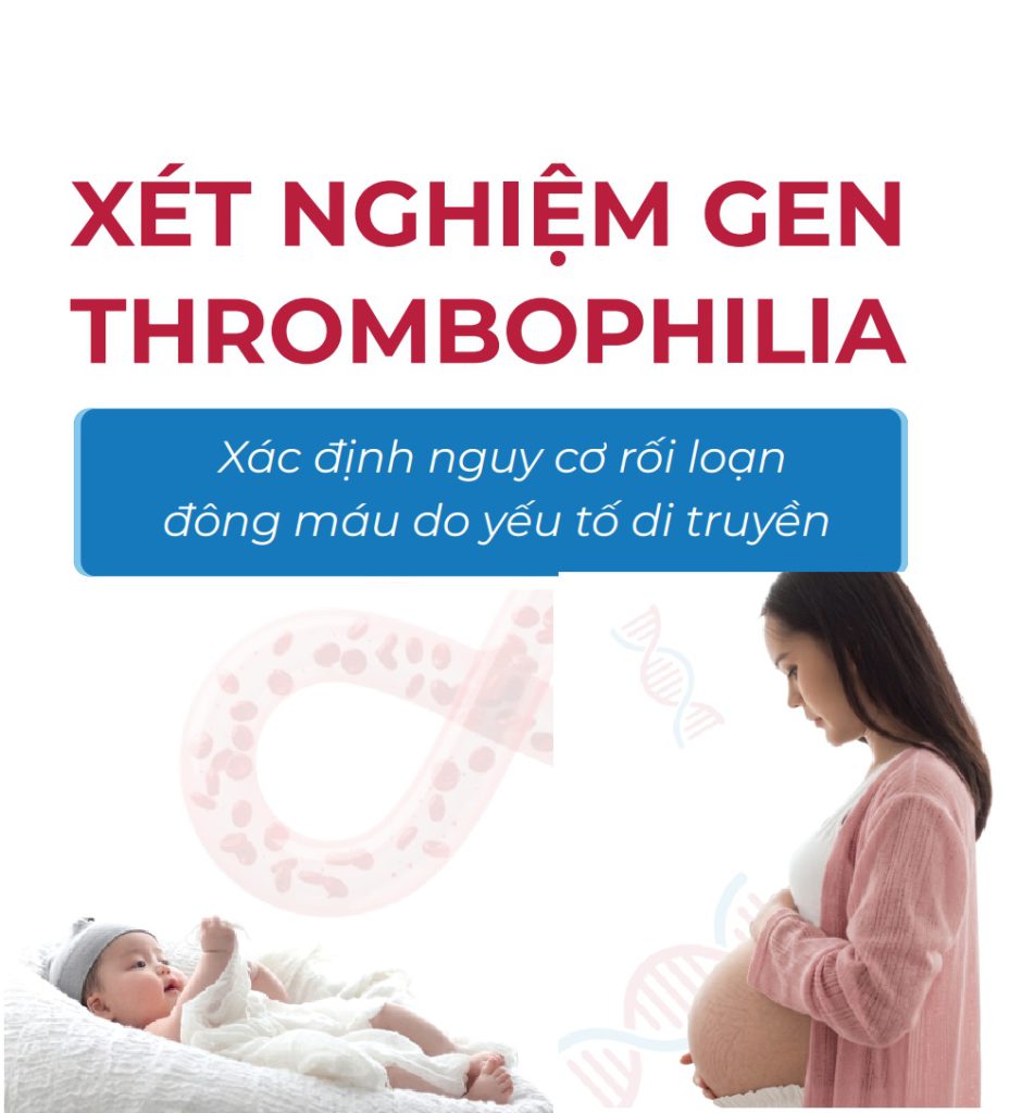 Xét nghiệm thrombophilia xác định nguy cơ rối loạn đông máu do yếu tố di truyền